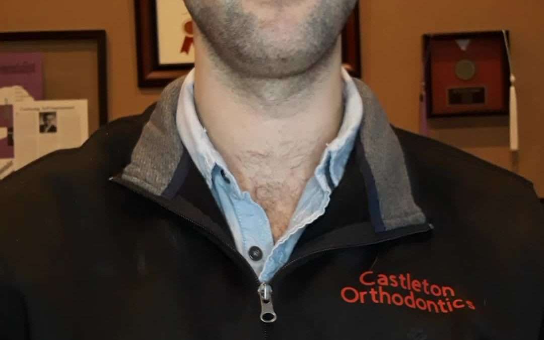 At what age should you bring your child to the orthodontist?